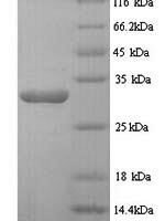 Human Desmoplakin (DSP), partial Recombinant Protein - BioCrest Sci