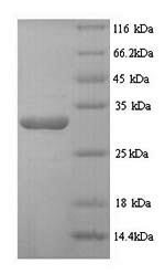 Human Desmoplakin (DSP), partial Recombinant Protein, Homo sapiens (Human), Yeast, N-terminal 6xHis-tagged, 28.1 kDa, purity >≥ 90% as determined by SDS-PAGE.