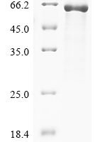 Rat Sterol carrier protein 2 (Scp2) Recombinant Protein - BioCrest Sci