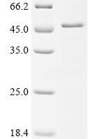 JC polyomavirus Major capsid protein VP1 Recombinant Protein - BioCrest Sci