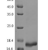 Severe acute respiratory syndrome coronavirus 2 ORF8 protein Recombinant Protein - BioCrest Sci