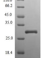 Human Extracellular superoxide dismutase [Cu-Zn] (SOD3) Recombinant Protein, N-His - BioCrest Sci