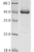 Agaricus bisporus Polyphenol oxidase 2 (PPO2) Recombinant Protein - BioCrest Sci