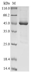 Agaricus bisporus Polyphenol oxidase 2 (PPO2) Recombinant Protein, Agaricus bisporus (White button mushroom), Baculovirus, C-terminal 6xHis-tagged, 44.7 kDa, purity >≥ 85% as determined by SDS-PAGE.