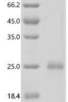 Rat Interleukin-7 (Il7) Recombinant Protein - BioCrest Sci