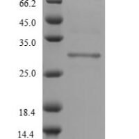 Mouse Protein delta homolog 2 (Dlk2), partial Recombinant Protein - BioCrest Sci
