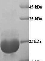 Onchocerca volvulus OV-16 antigen (OV16) Recombinant Protein - BioCrest Sci