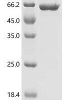 Newcastle disease virus Hemagglutinin-neuraminidase (HN), partial Recombinant Protein, C-His - BioCrest Sci