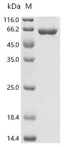 Newcastle disease virus Hemagglutinin-neuraminidase (HN), partial Recombinant Protein, C-His, Newcastle disease virus (strain Chicken/United States/LaSota/46) (NDV), E.coli, C-terminal 6xHis-tagged, 64.8 kDa, purity >≥ 85% as determined by SDS-PAGE.