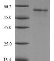Human [Pyruvate dehydrogenase [acetyl-transferring]]-phosphatase 2, mitochondrial (PDP2) Recombinant Protein - BioCrest Sci