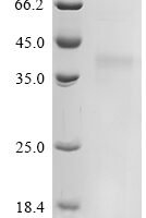 Felis catus (Cat) Creatine kinase (CKM), partial Recombinant Protein - BioCrest Sci