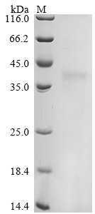 Felis catus (Cat) Creatine kinase (CKM), partial Recombinant Protein, Felis catus(Cat)(Felis silvestris catus), Yeast, Tag-Free, 28.4 kDa, purity >≥ 85% as determined by SDS-PAGE.