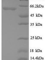 Mouse Angiopoietin-2 (Angpt2), partial Recombinant Protein - BioCrest Sci