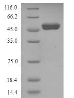 Human Wilms tumor protein (WT1) Recombinant Protein, N-His - BioCrest Sci