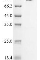 Escherichia coli Beta-galactosidase (lacZ),Biotinylated Recombinant Protein - BioCrest Sci