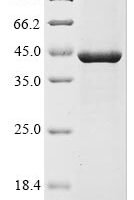 Varicella-zoster virus Envelope glycoprotein H (gH), partial Recombinant Protein, N-His - BioCrest Sci