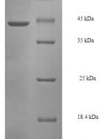 Saccharomyces cerevisiae Proliferating cell nuclear antigen (POL30) Recombinant Protein - BioCrest Sci