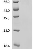 Escherichia coli Trehalose-6-phosphate synthase (otsA) Recombinant Protein, C-10His-HSA - BioCrest Sci