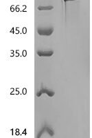 Human Cell adhesion molecule CEACAM5 (CEACAM5) (E398K), Biotinylated Recombinant Protein - BioCrest Sci