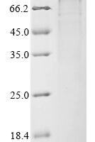 Haemophilus influenzae Transferrin-binding protein A (tbpA) Recombinant Protein - BioCrest Sci
