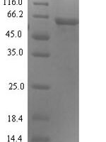 Human Syncytin-1 (ERVW-1), partial Recombinant Protein, N-His-SUMO - BioCrest Sci