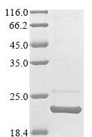 Shigella sonnei Transcriptional activator of defense systems (marA) Recombinant Protein - BioCrest Sci