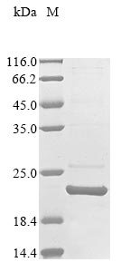 Shigella sonnei Transcriptional activator of defense systems (marA) Recombinant Protein, Shigella sonnei (strain Ss046), E.coli, N-terminal 10xHis-tagged and C-terminal Myc-tagged, 22.9 kDa, purity >≥ 85% as determined by SDS-PAGE.