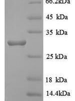Human HLA class II histocompatibility antigen, DRB1-12 beta chain (HLA-DRB1) Recombinant Protein - BioCrest Sci
