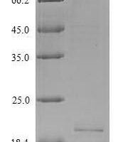 Human Interleukin-26 (IL26) Recombinant Protein - BioCrest Sci
