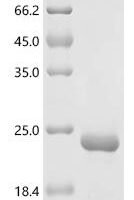 Osmia cornuta Odorant-binding protein 1 Recombinant Protein - BioCrest Sci