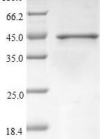 Betula pendula Calcium-binding allergen Bet v 3 (BETVIII) Recombinant Protein - BioCrest Sci