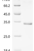 Mouse Tumor necrosis factor receptor superfamily member 3 (Ltbr), partial Recombinant Protein - BioCrest Sci