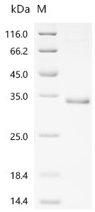 Mouse Tumor necrosis factor receptor superfamily member 3 (Ltbr), partial Recombinant Protein, Mus musculus (Mouse), E.coli, C-terminal 6xHis-tagged, 28.6 kDa, purity >≥ 90% as determined by SDS-PAGE.