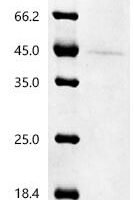 Mouse Neurogenic differentiation factor 1 (Neurod1)(M114A,H115A) Recombinant Protein, C-His, aa 1–357 (M114A,H115A), Yeast - BioCrest Sci