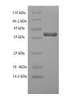 Human Dual specificity protein phosphatase 13 isoform MDSP (DUSP13) Recombinant Protein, Homo sapiens (Human), E.coli, N-terminal 6xHis-SUMO-tagged, 36.7 kDa, purity >≥ 90% as determined by SDS-PAGE.
