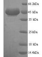 Human All-trans-retinol dehydrogenase [NAD (+)] ADH7 (ADH7) Recombinant Protein, N-His, aa 1–386, Yeast - BioCrest Sci