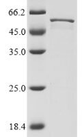 Human coronavirus NL63 Nucleoprotein (N) Recombinant Protein - BioCrest Sci