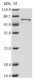 Human coronavirus NL63 Nucleoprotein (N) Recombinant Protein, Human coronavirus NL63 (HCoV-NL63), E.coli, N-terminal 6xHis-tagged, 48.2 kDa, purity >≥ 85% as determined by SDS-PAGE.