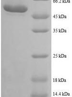 Human Trifunctional enzyme subunit beta, mitochondrial (HADHB), partial Recombinant Protein - BioCrest Sci
