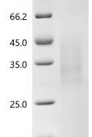 Human Immunoglobulin J chain (JCHAIN) Recombinant Protein, C-His, aa 23–159, Yeast - BioCrest Sci