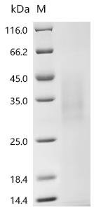 Human Immunoglobulin J chain (JCHAIN) Recombinant Protein, C-His, aa 23–159, Yeast, Homo sapiens (Human), Yeast, C-terminal 6xHis-tagged, 17.1 kDa, purity >≥ 90% as determined by SDS-PAGE.