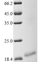 Human Myosin-7 (MYH7), partial Recombinant Protein - BioCrest Sci