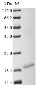 Human Myosin-7 (MYH7), partial Recombinant Protein, Homo sapiens (Human), Baculovirus, C-terminal 6xHis-tagged, 18.1 kDa, purity >≥ 85% as determined by SDS-PAGE.