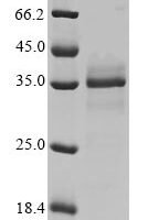 Mouse NAD-dependent protein deacylase sirtuin-5, mitochondrial (Sirt5) Recombinant Protein - BioCrest Sci