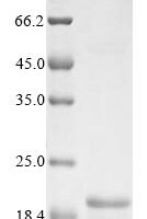 Escherichia coli Arsenical resistance operon repressor (arsR) Recombinant Protein - BioCrest Sci