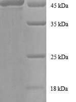 Human ADP-ribosylation factor 4 (ARF4) Recombinant Protein - BioCrest Sci
