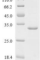 Mouse Mucosal pentraxin (Mptx) Recombinant Protein - BioCrest Sci