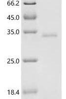Pig Complement C3 (C3), partial Recombinant Protein, C-His, aa 1001–1302, Yeast - BioCrest Sci