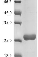Mouse Secretoglobin family 1C member 1 (Scgb1c1) Recombinant Protein - BioCrest Sci