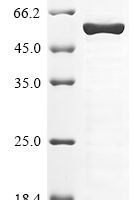 Human Chromobox protein homolog 8 (CBX8) Recombinant Protein, N-His - BioCrest Sci